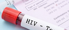 Новосибирцев приглашают пройти бесплатный экспресс-тест на ВИЧ